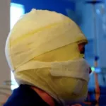 Según el último reporte, 15 personas que resultaron lesionadas con pólvora, se encontraban consumiendo bebidas embriagantes - Foto: Secretaría de Salud