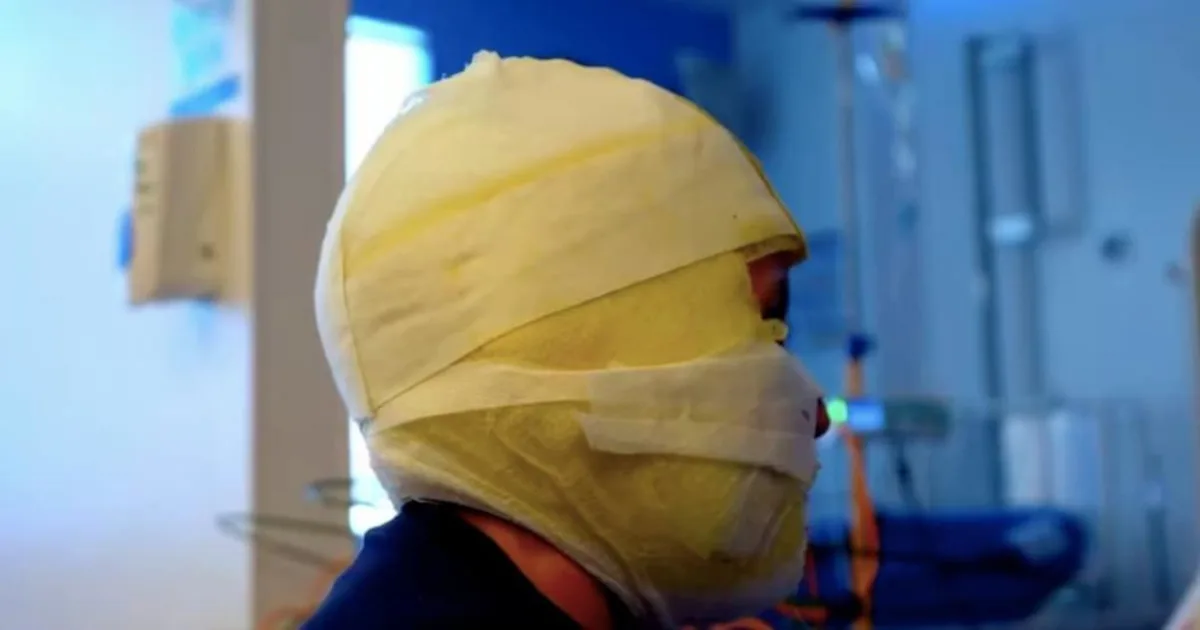 Según el último reporte, 15 personas que resultaron lesionadas con pólvora, se encontraban consumiendo bebidas embriagantes - Foto: Secretaría de Salud