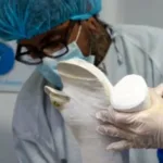 Desde la Alcaldía Mayor de Bogotá y la Secretaría Distrital de Salud (SDS) el llamado es a que quienes hayan sufrido lesiones acudan a los centros de salud - Foto: Secretaría de Salud