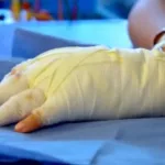 Entre los heridos por uso de fuegos pirotécnicos, según datos de la Secretaría Distrital de Salud (SDS), hay 28 personas que resultaron lesionadas cuando se encontraban consumiendo bebidas embriagantes - Foto: Secretaría de Salud