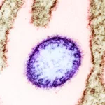 Las autoridades colombianas recordaron que Nipah es un virus zoonótico que puede pasar de animales —como murciélagos y otros hospedadores— a humanos, y en ocasiones también se ha documentado transmisión entre personas en contextos de contacto estrecho - Foto: NIAID