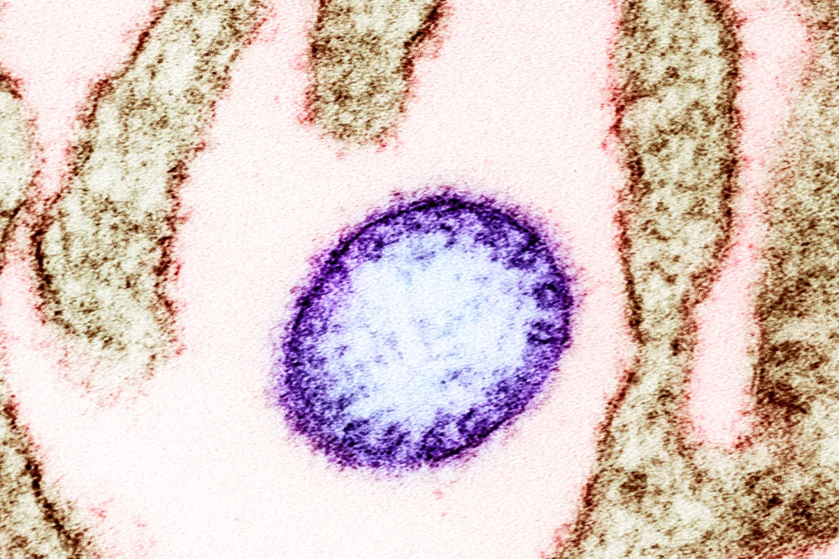 Las autoridades colombianas recordaron que Nipah es un virus zoonótico que puede pasar de animales —como murciélagos y otros hospedadores— a humanos, y en ocasiones también se ha documentado transmisión entre personas en contextos de contacto estrecho - Foto: NIAID